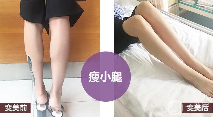 打*有副作用嗎？都有哪些副作用呢？