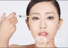 玻尿酸額頭一般打幾針*果?