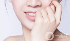 做整容手術是你2019計劃的一部分嗎?