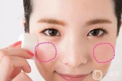 臉頰隆起的原因是什么 手術(shù)怎么做？