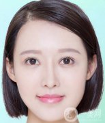 去紅色胎記留疤嗎？有哪些方法可以去胎記呢？