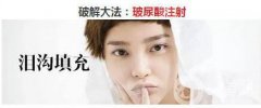 玻尿酸填充淚溝的危害 果怎么樣
