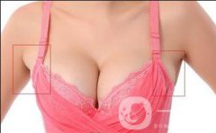 去副乳貴嗎？大概多少錢？