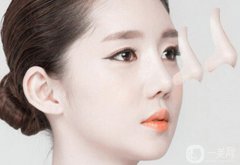 隆鼻哪種好 該如何選擇適合自己的方式？