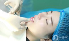 自體脂肪墊下巴貴嗎 一般多少錢？
