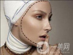 磨骨整形貴嗎？大概多少錢？