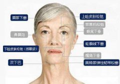 注射瘦臉生物除皺價(jià)格是多少 果怎么樣