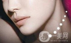 膨體墊下巴貴嗎？大概多少錢？
