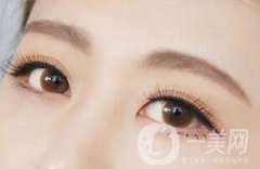 韓式三點(diǎn)雙眼皮價(jià)格是多少？和埋線雙眼皮的區(qū)別？