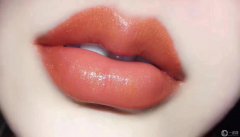 玻尿酸豐唇要幾支 普通女孩子負(fù)擔(dān)得起嗎？