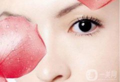 韓式三點雙眼皮優(yōu)勢有哪些 有什么注意事項呢？