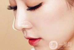 非手術(shù)隆鼻多少錢？果自然嗎？