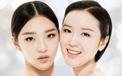 雙下巴怎么形成的 如何去掉雙下巴？