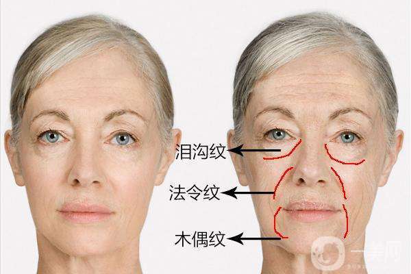 雕塑美學能治什么 雕塑美學調節(jié)時間