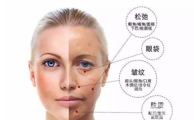 雕塑美學能治什么 雕塑美學調節(jié)時間