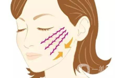 埋線面部提升多久恢復(fù) 術(shù)后如何護(hù)理？