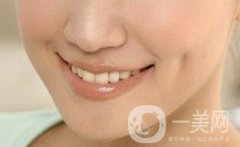 人造酒窩前后照片一覽？大概要多少錢？