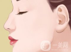 駝峰鼻手術(shù)價(jià)格一般是多少？