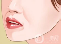 自體脂肪填充鼻唇溝怎么樣 能保持多久？