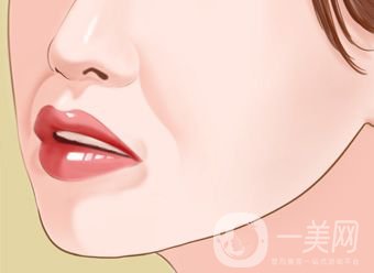 自體脂肪填充鼻唇溝怎么樣 能保持多久？