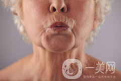 出現(xiàn)煙民線該如何解決呢？