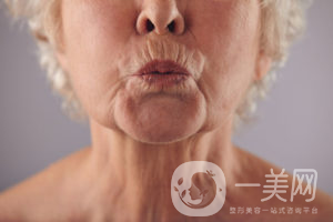 出現(xiàn)煙民線該如何調(diào)節(jié)呢？