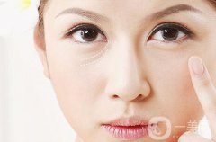 淚溝填充消腫需要多長時間？