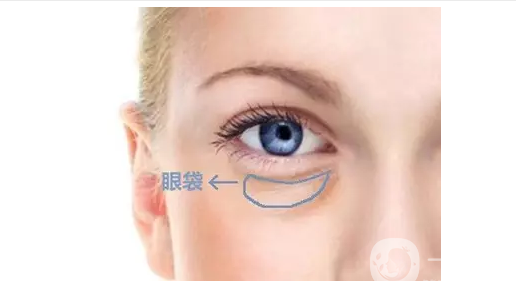 去眼袋手術(shù)費(fèi)用是多少錢 *果*嗎