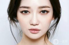 微型面部輪廓是什么 哪些人適合做面部輪廓