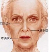打去皺紋針的危害有哪些呢?