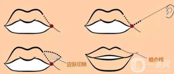 標準的仰月唇女明星有哪些？其中還有AB的整容模板！