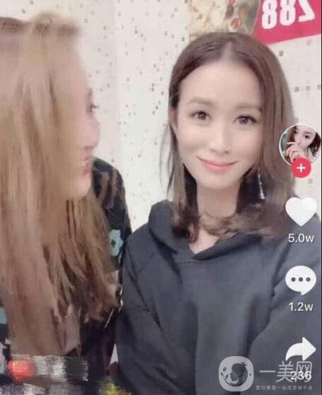 佘詩曼整容