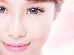 改變臉型手術(shù)要多少錢呢？