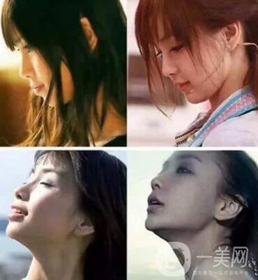 有沒有可能Angelababy不做整容手術(shù)就改變了這么多？