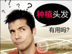 植發(fā)的危害有什么?優(yōu)點和價格介紹?