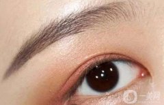 上眼皮吸脂價(jià)格多少？上眼皮吸脂后變雙眼皮？