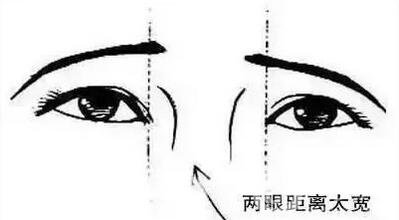 開眼角疼嗎？這幾種情況開眼角*果堪比換頭！