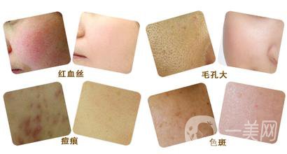 彩光嫩膚好嗎？*果如何？