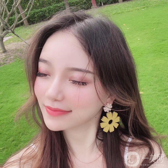 植發(fā)半年后案例 植發(fā)怎么樣？