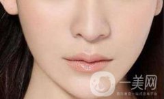 下巴打幾次能定型*？玻尿酸墊下巴多少錢？