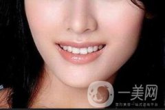 假體做下巴大概多少錢？