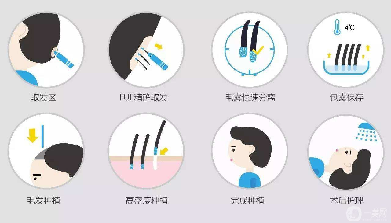 科普：植發(fā)3000單位要多少錢(qián)？脫發(fā)的原因