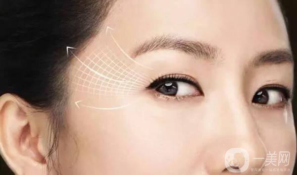 眼部除皺的價錢 怎么去眼周細紋