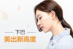 假體下巴風(fēng)險(xiǎn)有哪些？做完能管多久