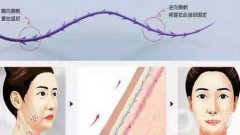 過了25歲該怎么辦？抗衰方式分享