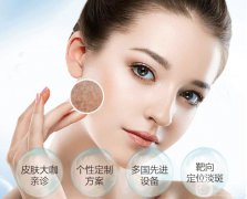 *風(fēng)范祛斑果怎么樣?大概多少錢？