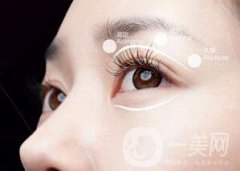 割雙眼皮有哪些風(fēng)險(xiǎn)？有失敗的嗎？