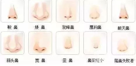 朝天鼻整形多少錢(qián)?*丑的幾種鼻子圖片