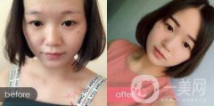 成都紋眉價(jià)格 成都現(xiàn)在文眉多少錢?