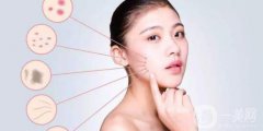 激光除斑要幾天才好 激光除斑多久可以洗臉呢